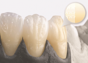 Ceramill Zolid FX Multilayer