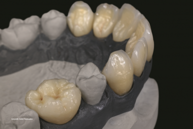 Ceramill Zolid - DNA Generation