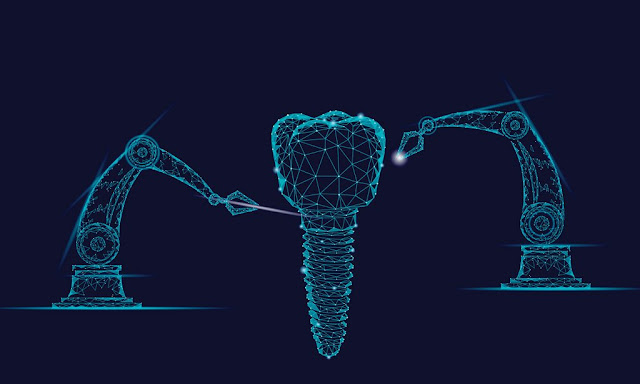 AI TRÍ TUỆ NHÂN TẠO VÀ CUỘC CÁCH MẠNG TRONG CHUẨN ĐOÁN, ĐIỀU TRỊ RĂNG MIỆNG TOÀN DIỆN